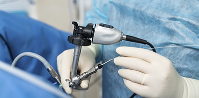 Полипы в кишечнике: чем опасны и почему их нужно удалять вовремя