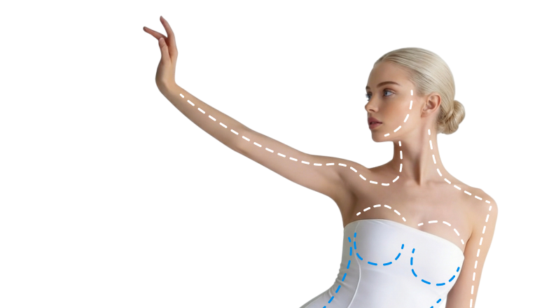 Бодилифт (торсопластика)