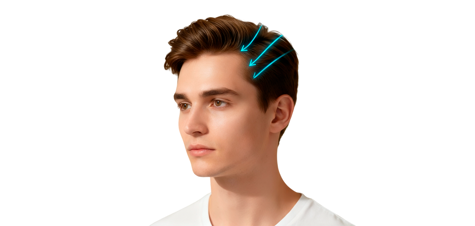 Пересадка волос (забор графтов методом FUE и посадка луковиц методом DHI)