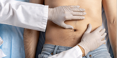 Операция по удалению пупочной грыжи в Ростове-на-Дону - клиника Евродон