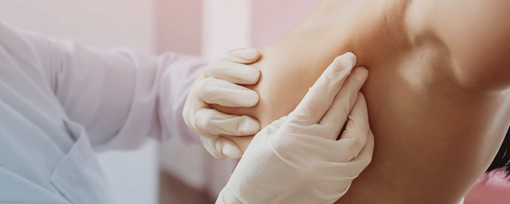 Лечение мастопатии, симптомы, профилактика, рекомендации специалистов