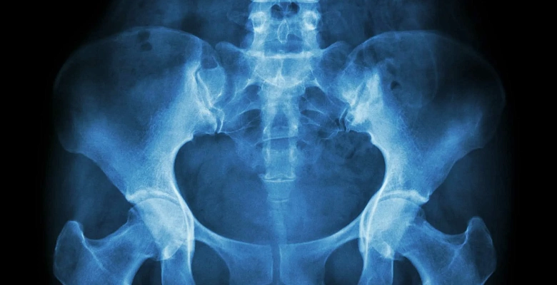 Рентген костей таза