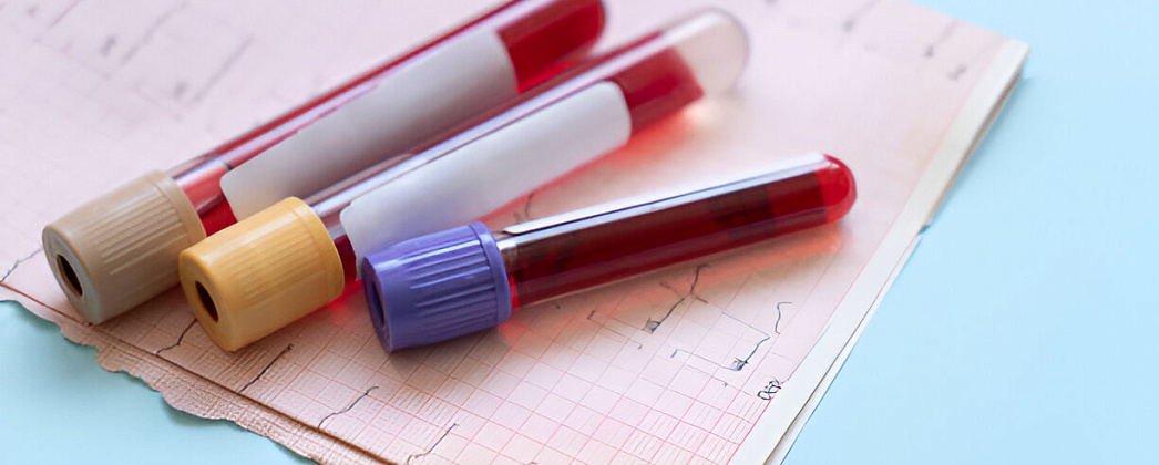 Современные методы анализа крови: от общего анализа до биохимии 