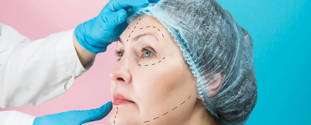 Минус 10 лет за один день: что дает современная подтяжка лица