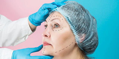 Минус 10 лет за один день: что дает современная подтяжка лица