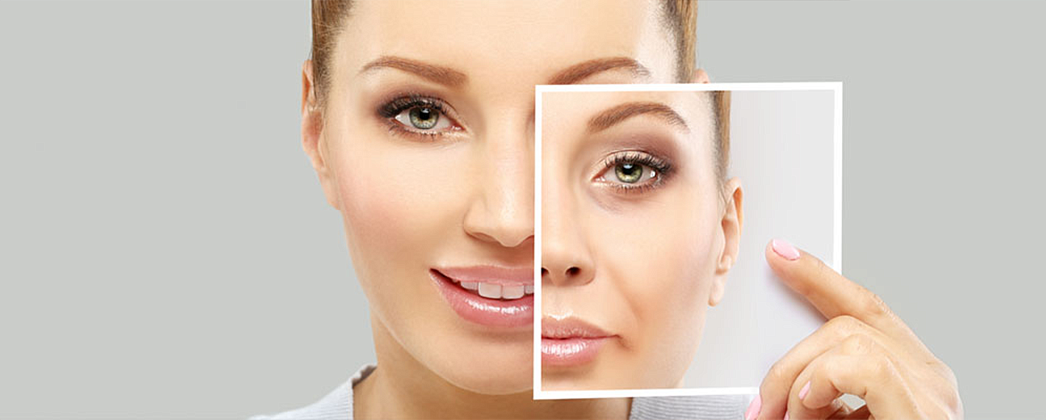 Можно ли совместить блефаропластику и подтяжку лица? Ответ хирурга клиники Евродон