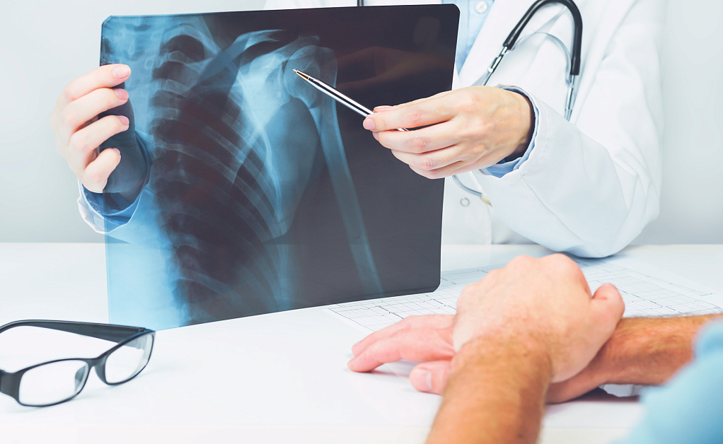 Rentgen verhnih plechevih sustavov v Evrodone