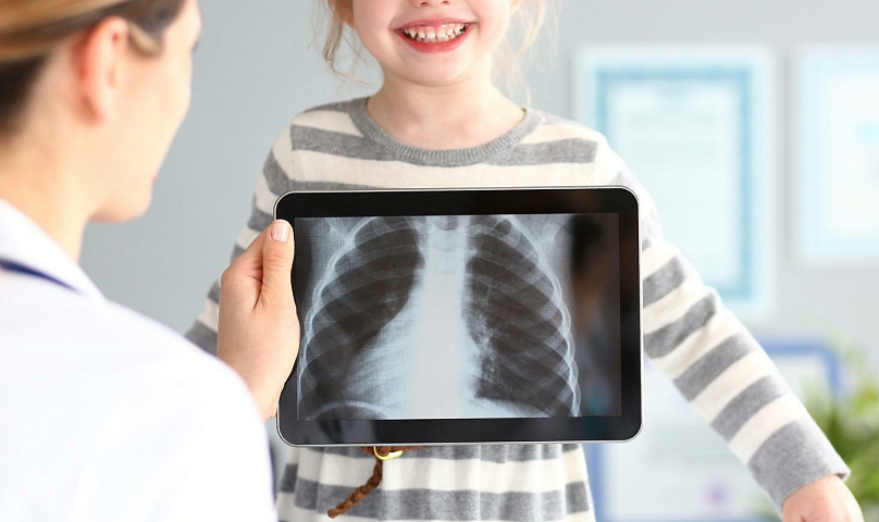 Rentgen dlya detei v klinike Evrodon