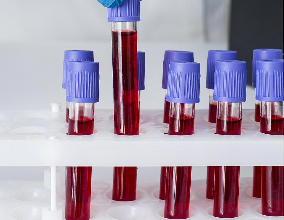 Izoserologiya v klinike Evrodon