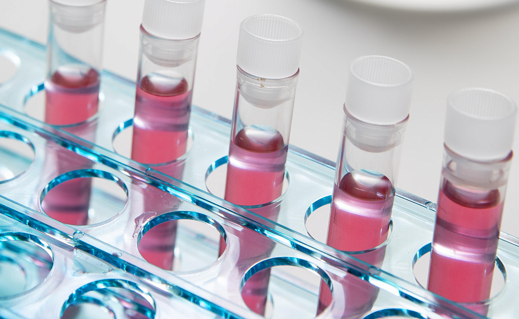 Analiz na autoimmunnie zabolevaniya v klinike Evrodon