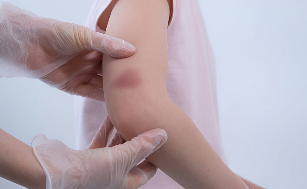 Detskii travmatolog v klinike Evrodon