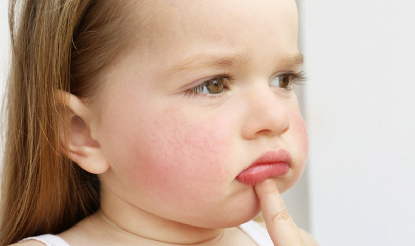 Allergiya u detei v klinike Evrodon