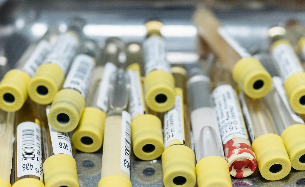 Neirosensornaya tugouhost analiz v rostove 