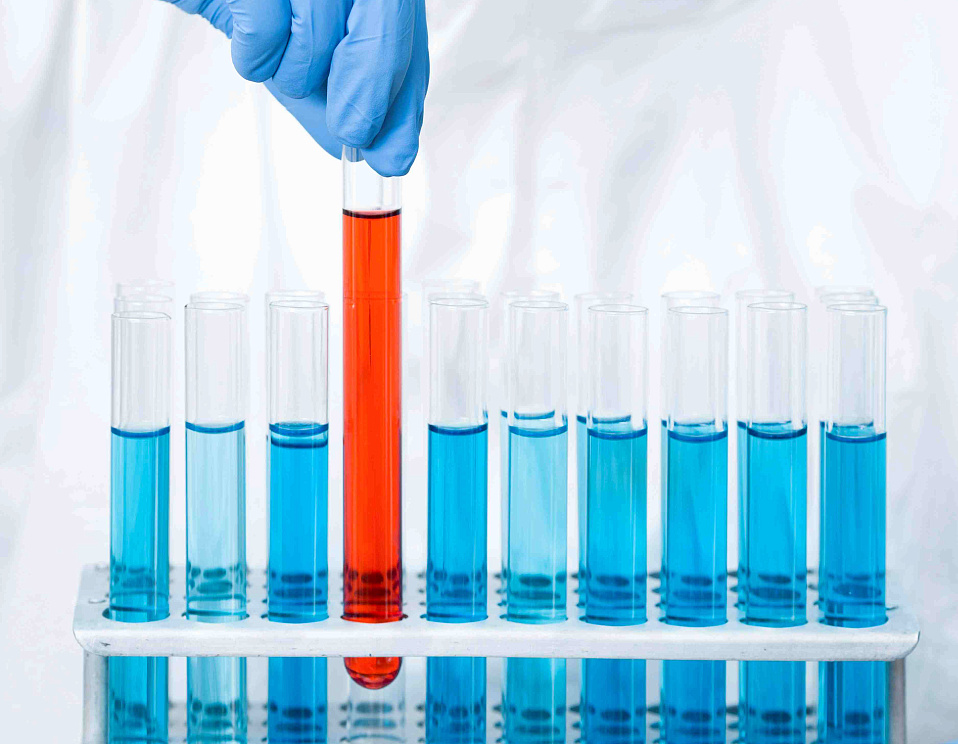 analiz na narkoticheskie veschestva v klinike eurodon