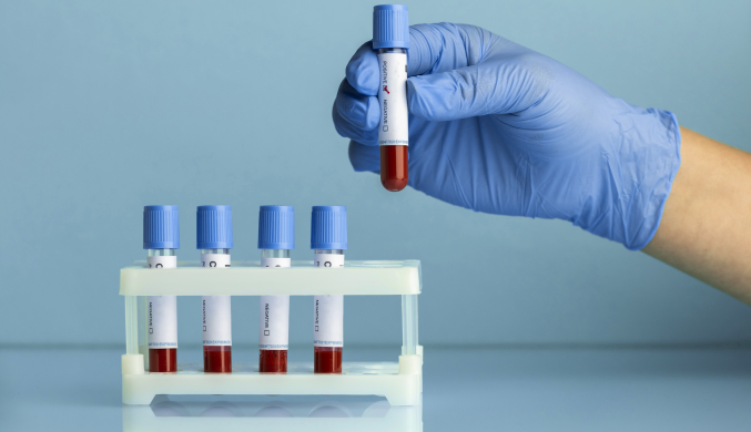 Klinika_Evrodon_Gematologiya_5