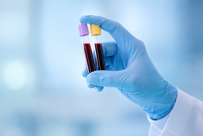 Autoimmunnie_zabolevaniya_03_Klinika_Evrodon