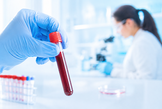 Biohimicheskie_issledovaniya_02_Klinika_Evrodon