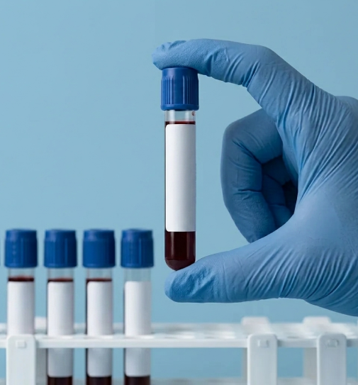 Gematologiya_povyazki_Klinika_Evrodon