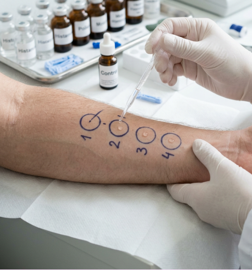 2_Diagnostika_allergii_klinika_Evrodon