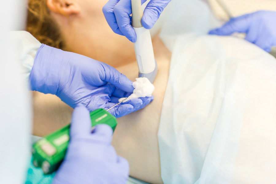 Punkciya v mammologii v klinike Evrodon